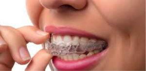 A woman who is using clear aligners